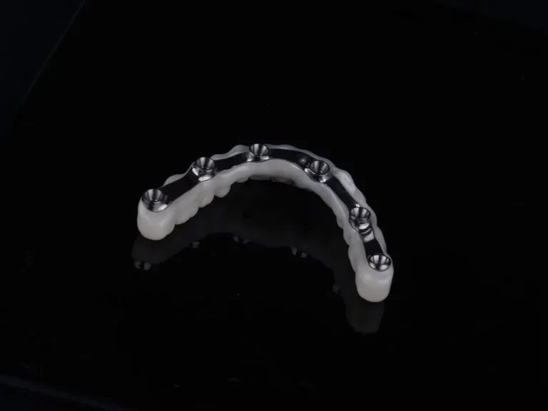 İstanbul'da all-on-6 implant ile tam ark sabit protez uygulaması