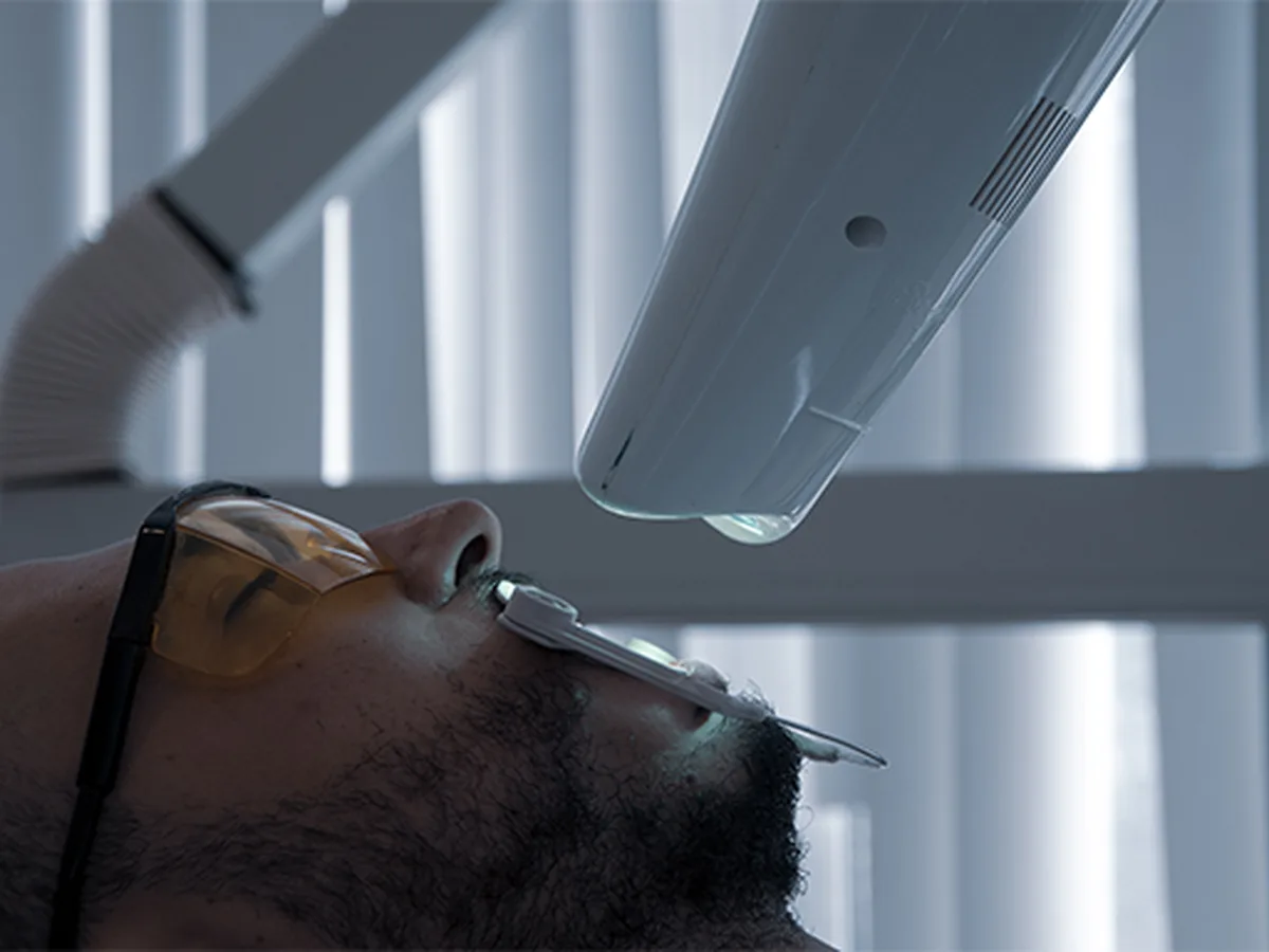 Teeth whitening treatment steps at CityDent Istanbul