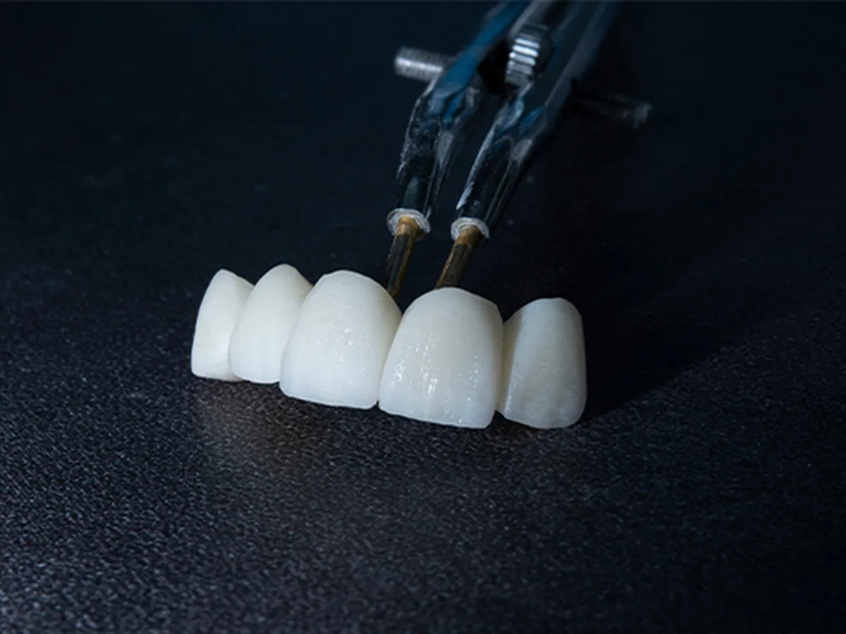 Tooth shade options available for dental restorations in Istanbul