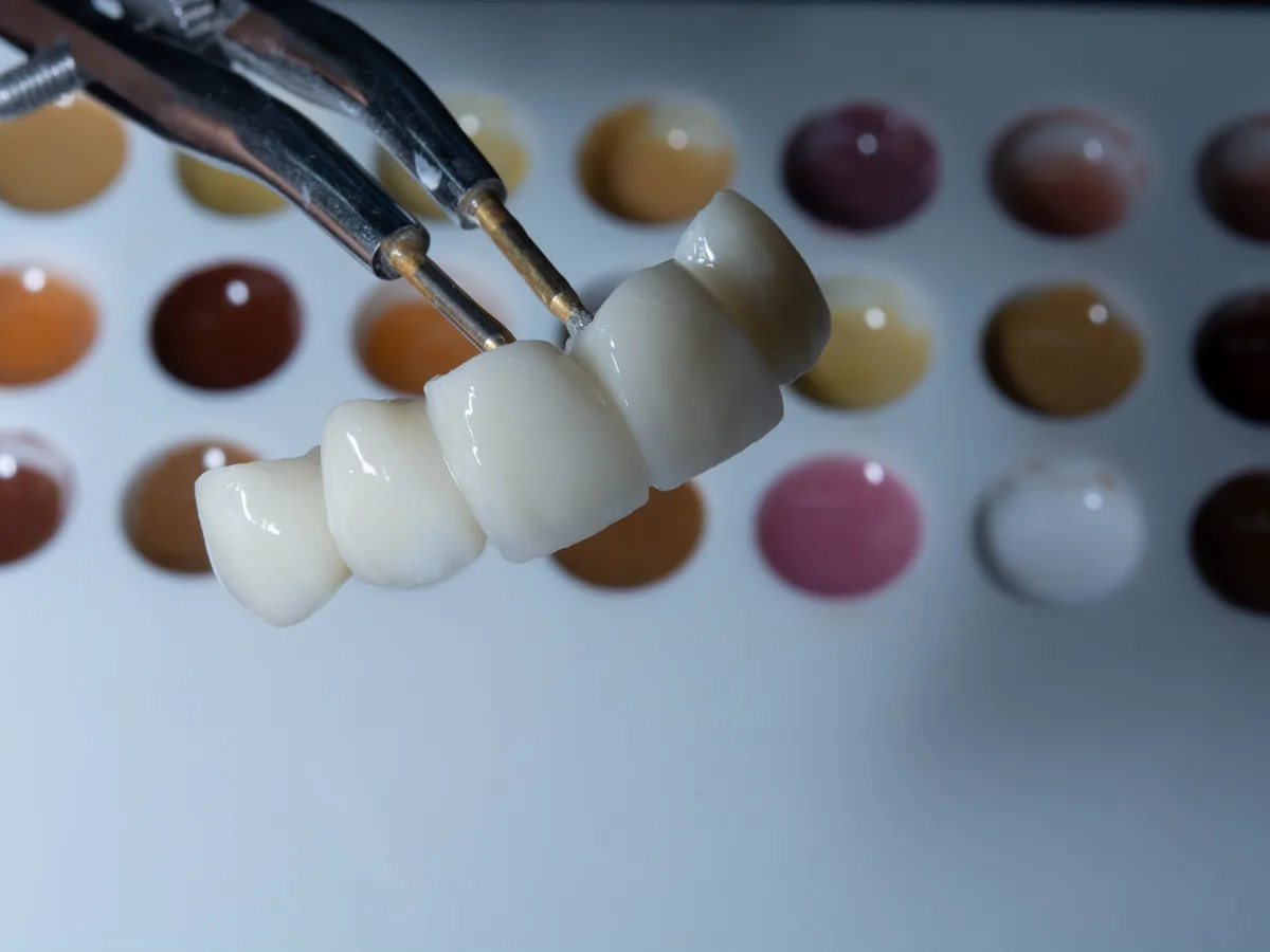 Tooth colour guide for dental treatments in Istanbul