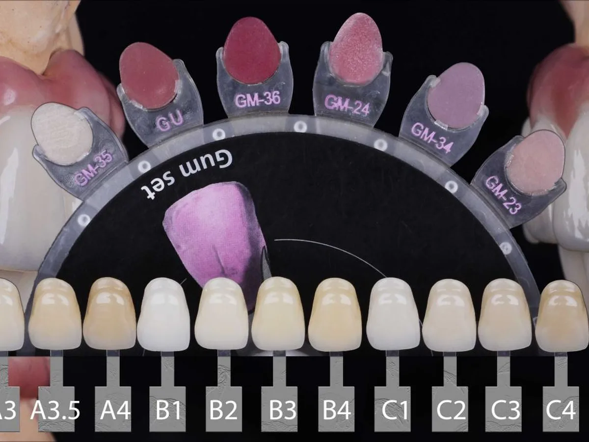 Tooth shade guide chart used by dentists in Istanbul
